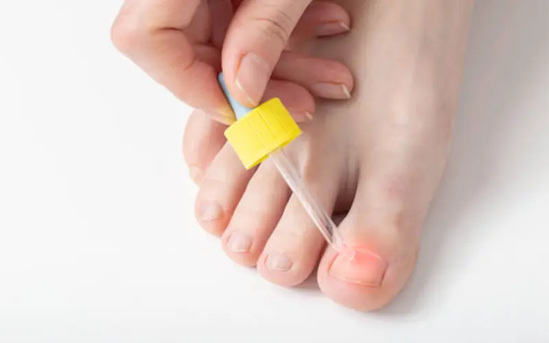 1 Fl.Oz Anti Fungal Treatment Fungus Finger Toe Nail Repair Liquid Natural  | eBay