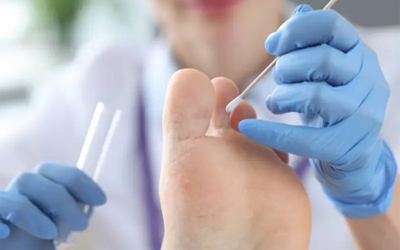 Molecular Nail and Wound Testing